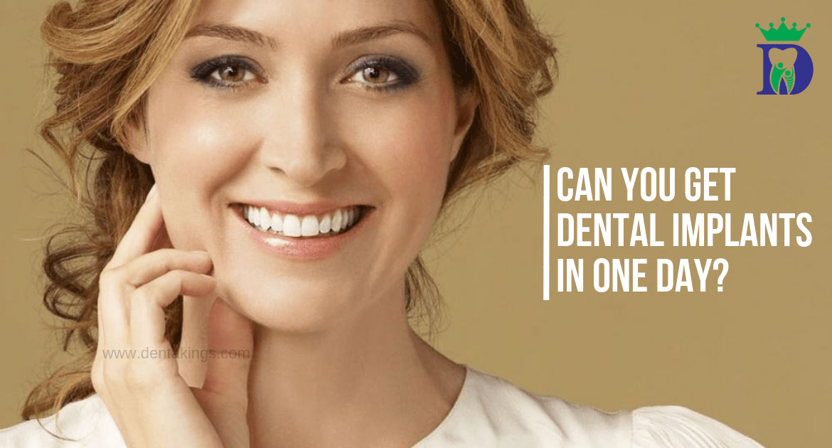 Can you get Dental implants in one day?