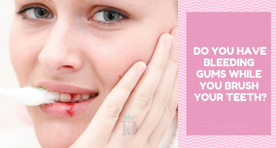Do you have bleeding gums while you brush your teeth?