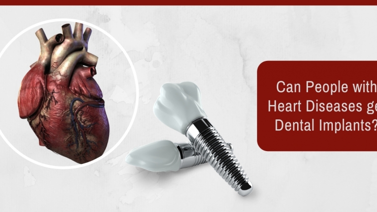 Can people with heart diseases get dental implants?
