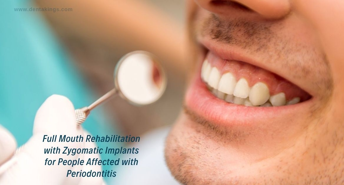 Full Mouth Rehabilitation with Zygomatic Implants for people affected with Periodontitis