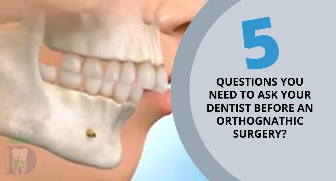 Five questions that you need to ask your Dentist before an Orthognathic Surgery